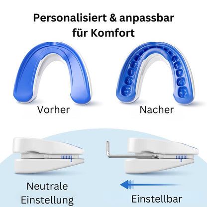 All-in-One Anti-Schnarch-Schiene (Zahnschutz)